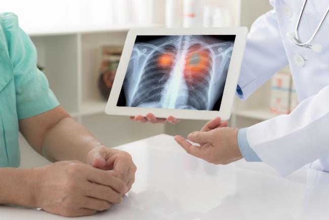 רופא מראה למטופל צילום רנטגן המעיד על גידול בריאות